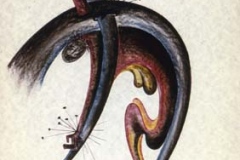 Todesart 9